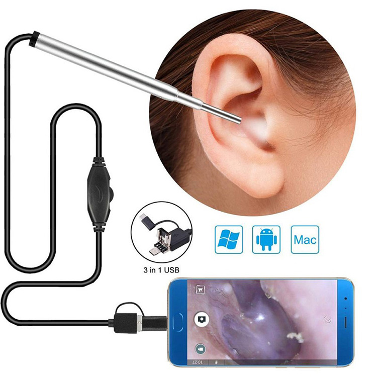 Medical Endoscope Ikhamera Indlebe Ekhaleni Endoscope Usb Otoscope