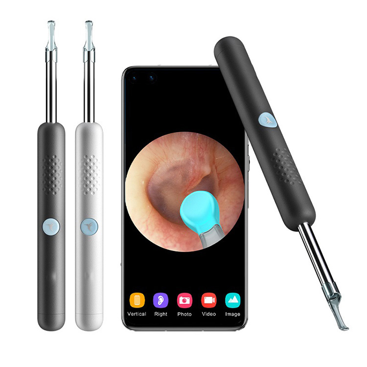 I-Otoscope yezokwelapha